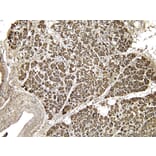 Immunohistochemistry - Anti-EPS8 Antibody (A83960) - Antibodies.com