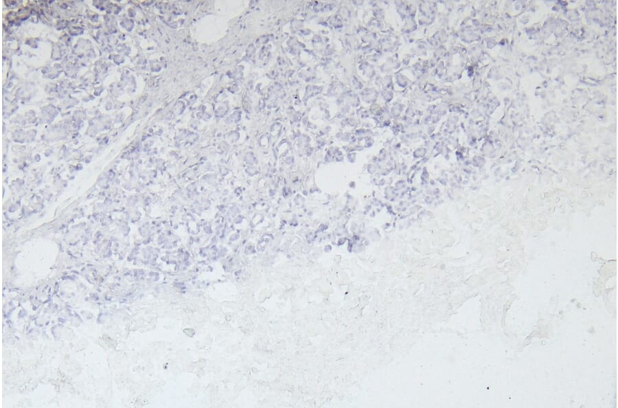 Immunohistochemistry - Anti-EPS8 Antibody (A83960) - Antibodies.com