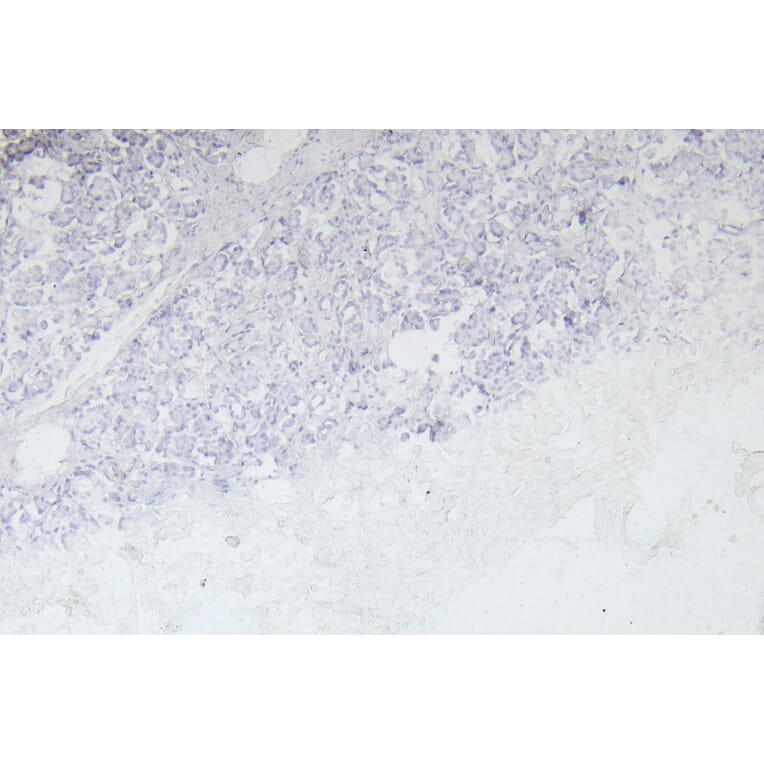 Immunohistochemistry - Anti-EPS8 Antibody (A83960) - Antibodies.com