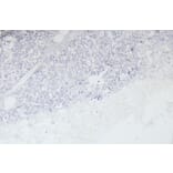Immunohistochemistry - Anti-EPS8 Antibody (A83960) - Antibodies.com