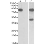 Western Blot - Anti-NUMBL Antibody (A83961) - Antibodies.com