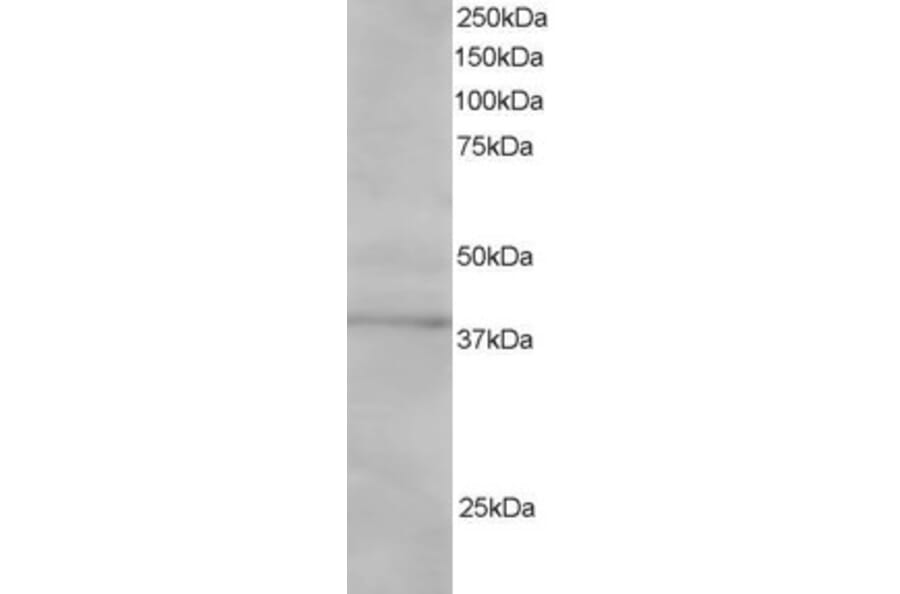 Western Blot - Anti-SAE1 Antibody (A83962) - Antibodies.com