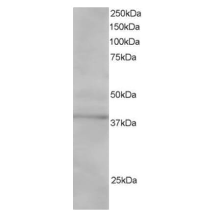 Western Blot - Anti-SAE1 Antibody (A83962) - Antibodies.com