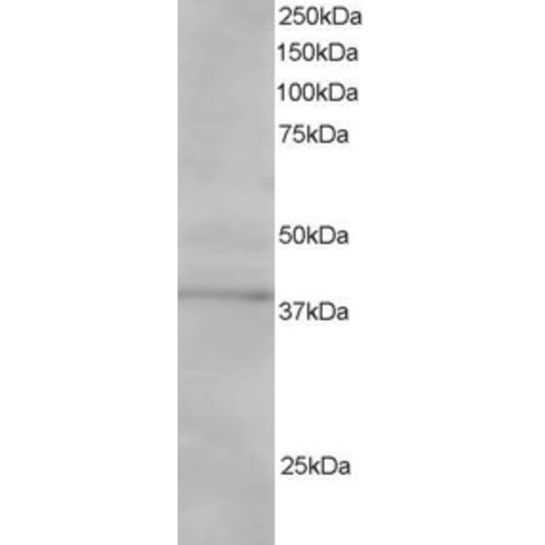 Western Blot - Anti-SAE1 Antibody (A83962) - Antibodies.com