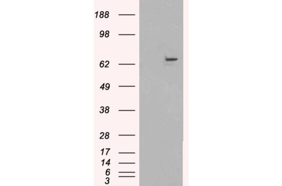 Western Blot - Anti-FANCG Antibody (A83967) - Antibodies.com