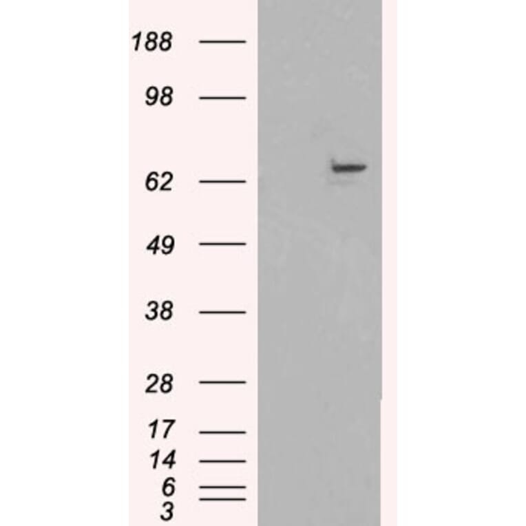 Western Blot - Anti-FANCG Antibody (A83967) - Antibodies.com