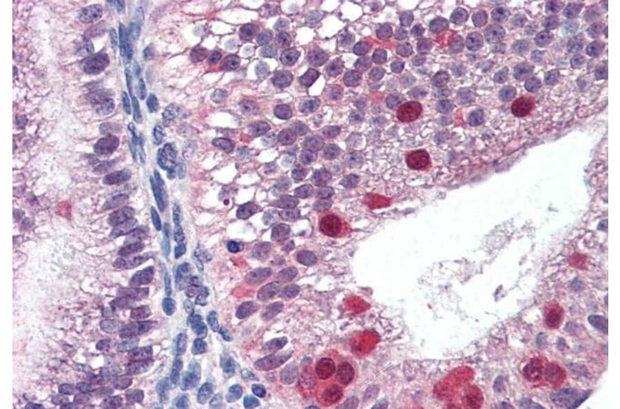 Immunohistochemistry - Anti-FANCG Antibody (A83967) - Antibodies.com