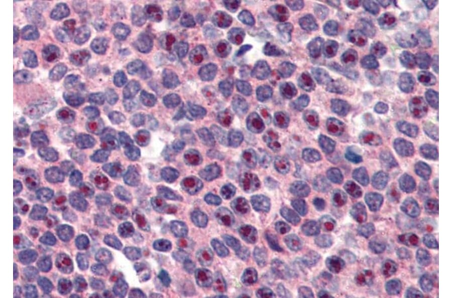 Immunohistochemistry - Anti-FANCG Antibody (A83967) - Antibodies.com