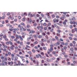 Immunohistochemistry - Anti-FANCG Antibody (A83967) - Antibodies.com
