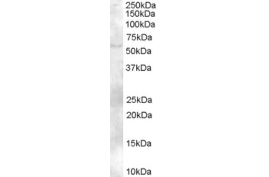 Western Blot - Anti-TZFP/ZBTB32 Antibody (A83968) - Antibodies.com