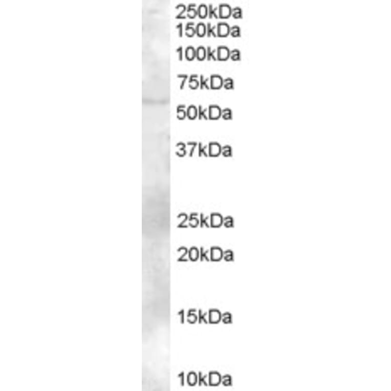 Western Blot - Anti-TZFP/ZBTB32 Antibody (A83968) - Antibodies.com