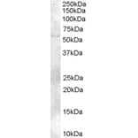 Western Blot - Anti-TZFP/ZBTB32 Antibody (A83968) - Antibodies.com