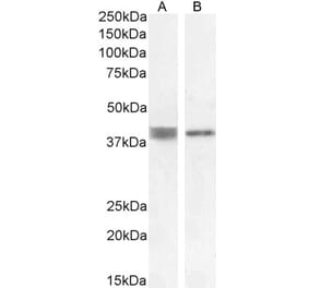 Western Blot - Anti-Renin Receptor Antibody (A83969) - Antibodies.com