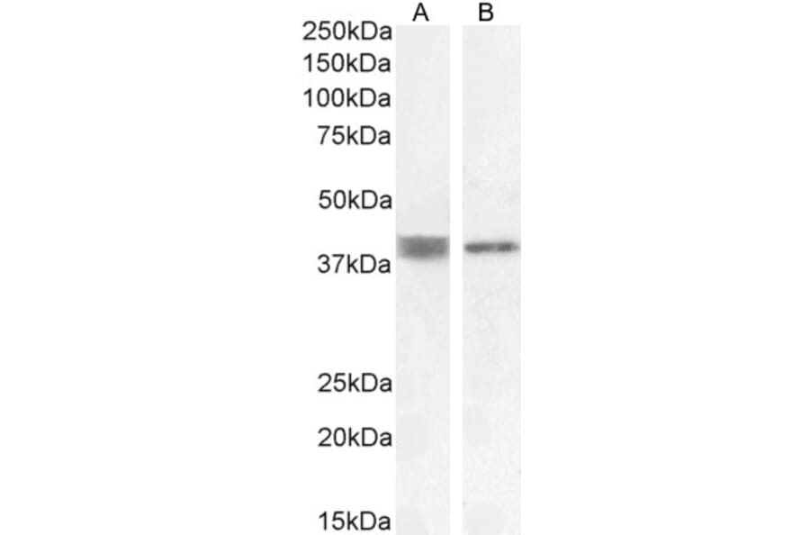 Western Blot - Anti-Renin Receptor Antibody (A83969) - Antibodies.com
