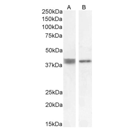 Western Blot - Anti-Renin Receptor Antibody (A83969) - Antibodies.com