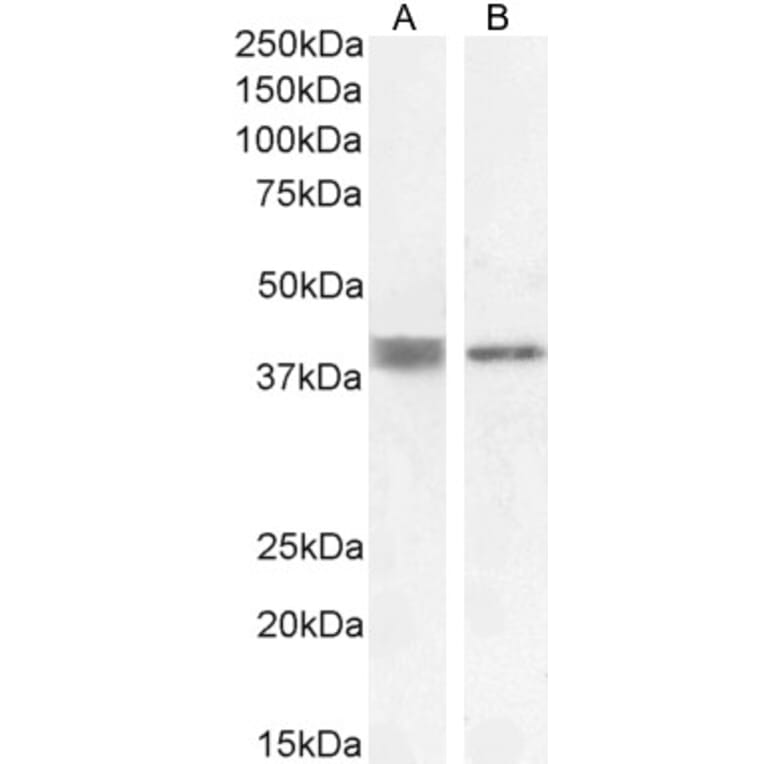 Western Blot - Anti-Renin Receptor Antibody (A83969) - Antibodies.com