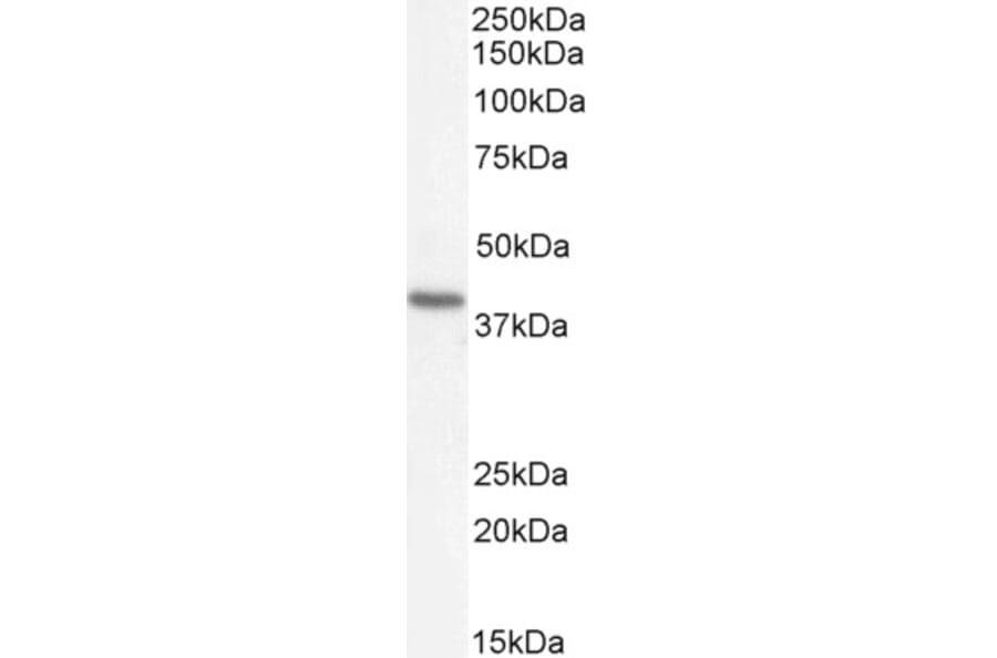 Western Blot - Anti-Renin Receptor Antibody (A83969) - Antibodies.com