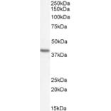 Western Blot - Anti-Renin Receptor Antibody (A83969) - Antibodies.com
