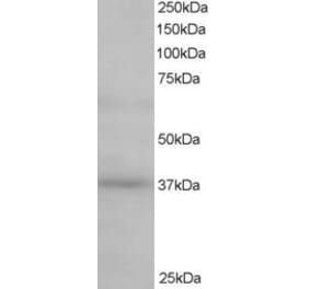 Western Blot - Anti-ATP6AP2 Antibody (A83969) - Antibodies.com