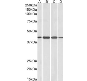 Western Blot - Anti-Centaurin alpha 1 Antibody (A83970) - Antibodies.com