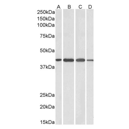 Western Blot - Anti-Centaurin alpha 1 Antibody (A83970) - Antibodies.com