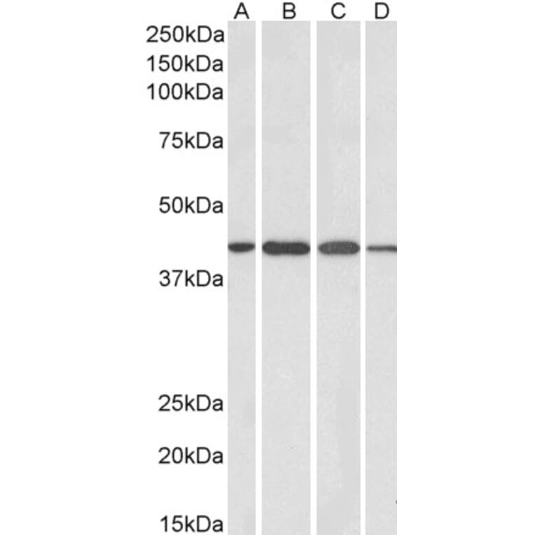 Western Blot - Anti-Centaurin alpha 1 Antibody (A83970) - Antibodies.com