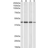Western Blot - Anti-Centaurin alpha 1 Antibody (A83970) - Antibodies.com