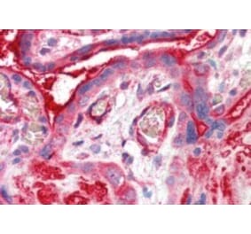 Immunohistochemistry - Anti-ADAP2 Antibody (A83971) - Antibodies.com