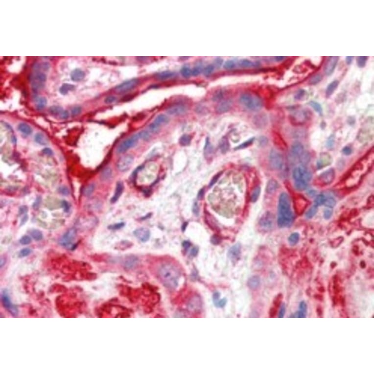 Immunohistochemistry - Anti-ADAP2 Antibody (A83971) - Antibodies.com