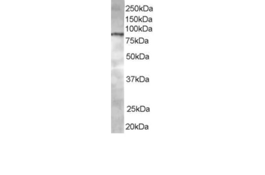 Western Blot - Anti-ACAP1 Antibody (A83972) - Antibodies.com