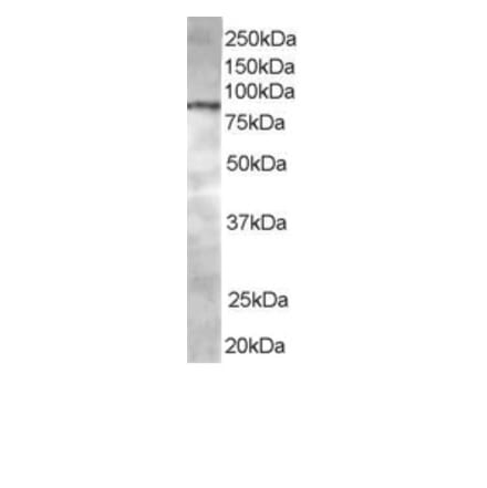 Western Blot - Anti-ACAP1 Antibody (A83972) - Antibodies.com