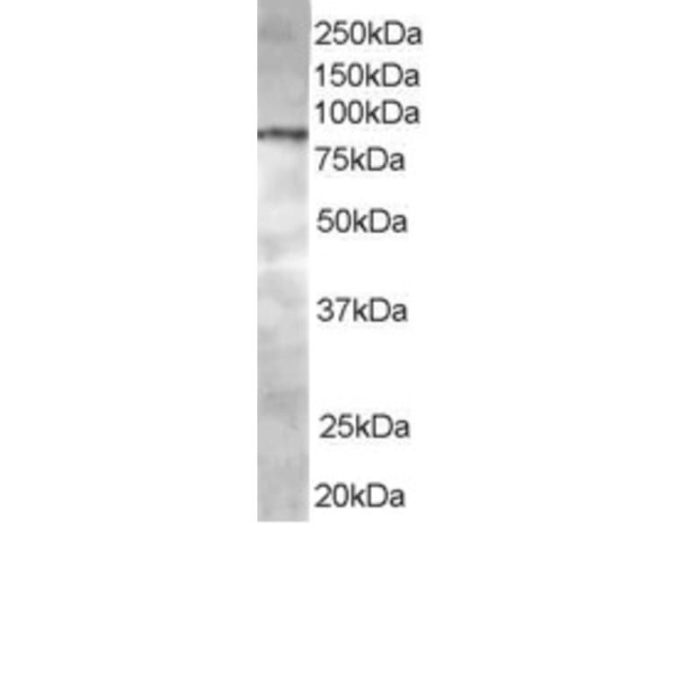 Western Blot - Anti-ACAP1 Antibody (A83972) - Antibodies.com