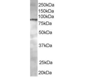 Western Blot - Anti-ACAP1 Antibody (A83972) - Antibodies.com
