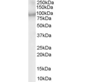 Western Blot - Anti-ACAP2 Antibody (A83973) - Antibodies.com