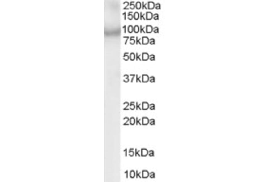 Western Blot - Anti-ACAP2 Antibody (A83973) - Antibodies.com