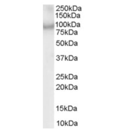 Western Blot - Anti-ACAP2 Antibody (A83973) - Antibodies.com