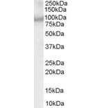 Western Blot - Anti-ACAP2 Antibody (A83973) - Antibodies.com