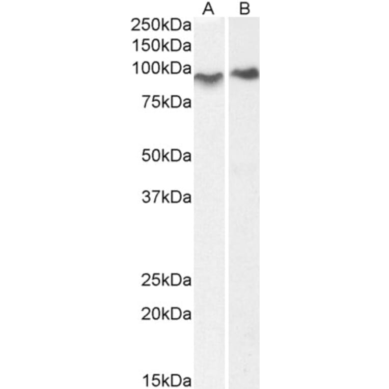 Western Blot - Anti-ACAP2 Antibody (A83973) - Antibodies.com