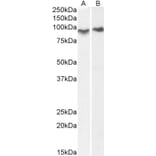 Western Blot - Anti-ACAP2 Antibody (A83973) - Antibodies.com