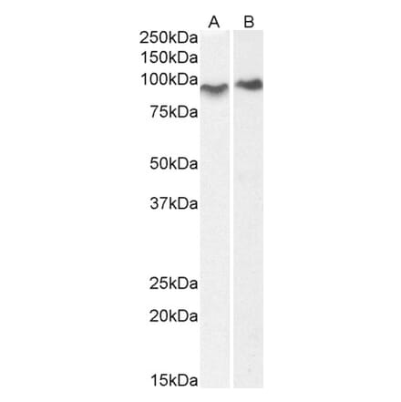 Western Blot - Anti-ACAP2 Antibody (A83973) - Antibodies.com