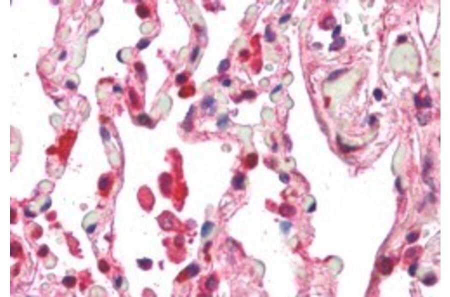 Immunohistochemistry - Anti-ACAP2 Antibody (A83973) - Antibodies.com