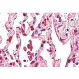 Immunohistochemistry - Anti-ACAP2 Antibody (A83973) - Antibodies.com