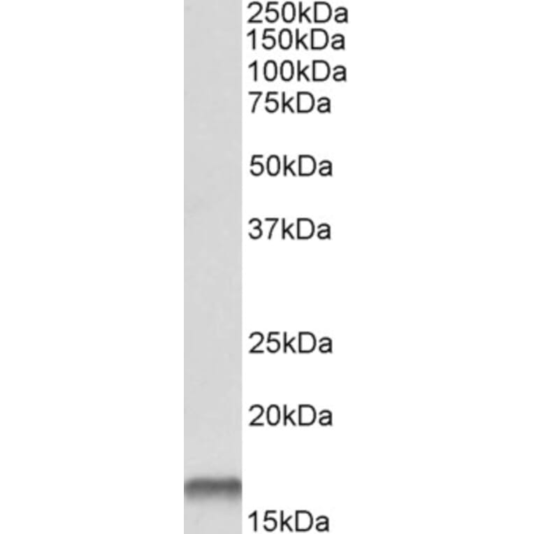 Western Blot - Anti-Cystatin-B Antibody (A83975) - Antibodies.com