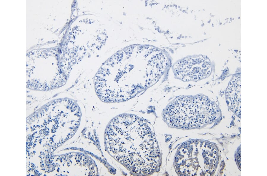 Immunohistochemistry - Anti-Cystatin-B Antibody (A83975) - Antibodies.com