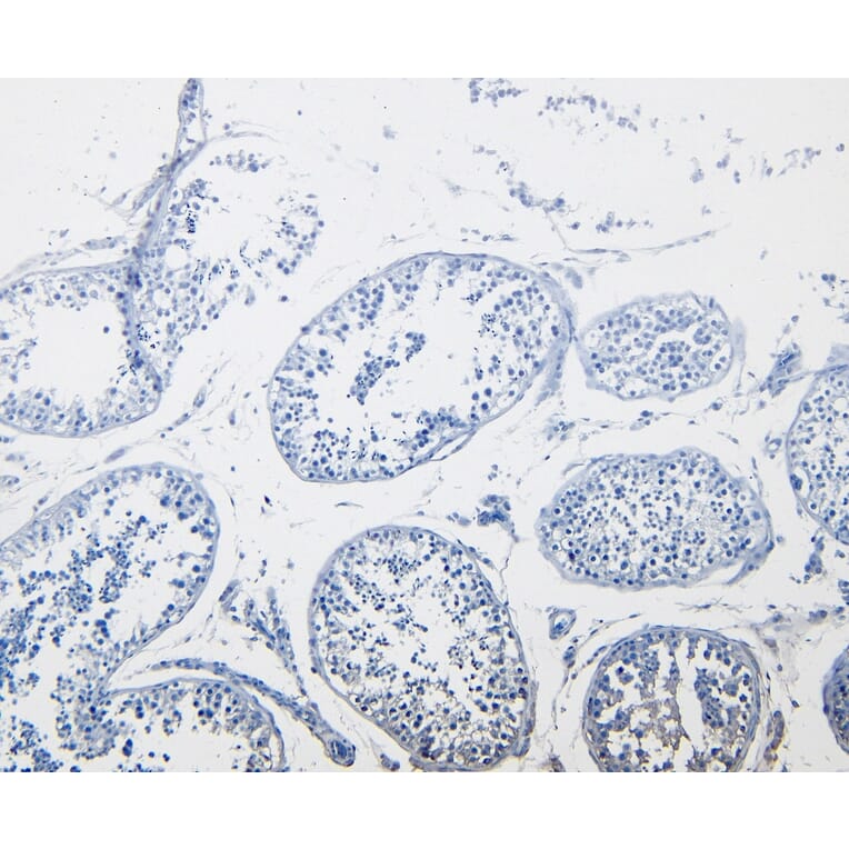 Immunohistochemistry - Anti-Cystatin-B Antibody (A83975) - Antibodies.com