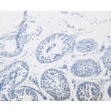 Immunohistochemistry - Anti-Cystatin-B Antibody (A83975) - Antibodies.com