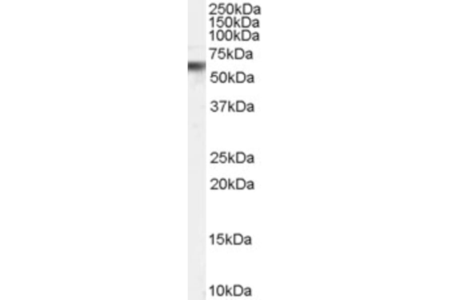 Western Blot - Anti-VPS45A (C Terminus) Antibody (A83977) - Antibodies.com