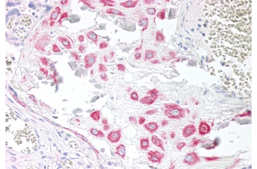 Immunohistochemistry - Anti-VPS45A (C Terminus) Antibody (A83977) - Antibodies.com