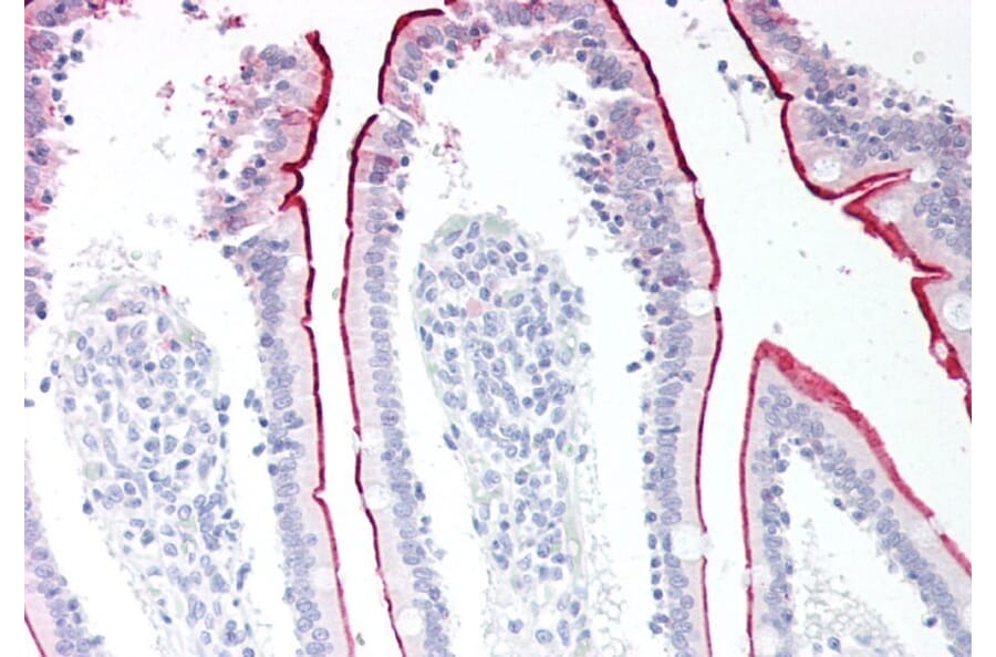 Immunohistochemistry - Anti-VPS45A (C Terminus) Antibody (A83977) - Antibodies.com