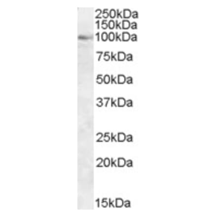 Western Blot - Anti-OSBP1 Antibody (A83978) - Antibodies.com